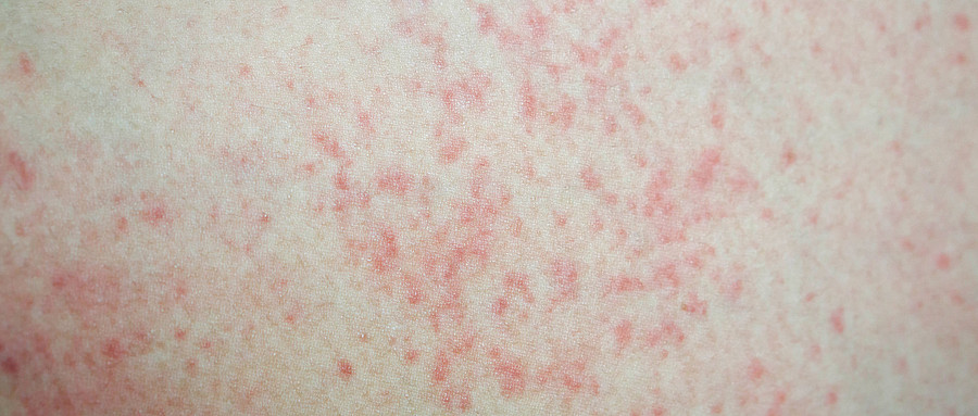 情緒護(hù)膚,心理學(xué),情緒評估,科學(xué)工具