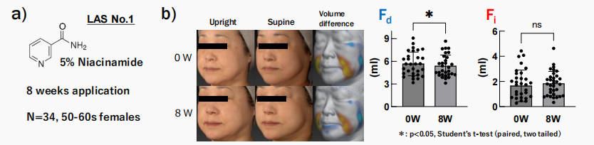 CIRS功效評價,技術實踐,下垂,水腫,定量評估